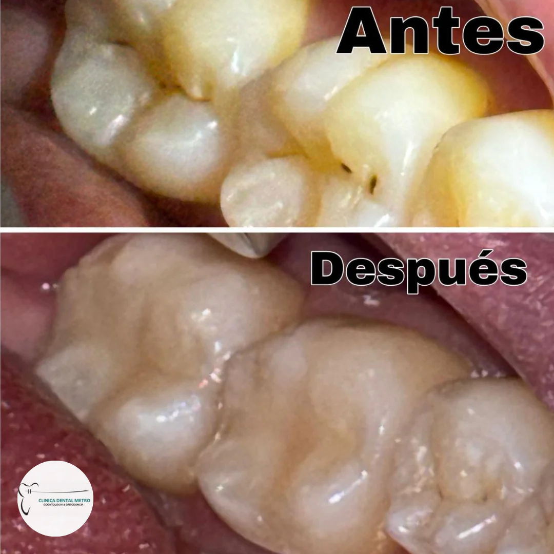 Imagen del producto 2
